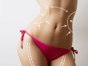 Liposuzione e Liposcultura